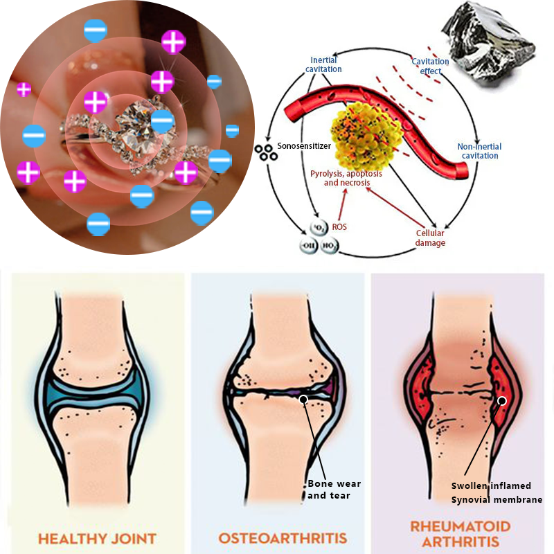 SlimShape Magnetic Detox Ring – Sculpt Your Ideal Body